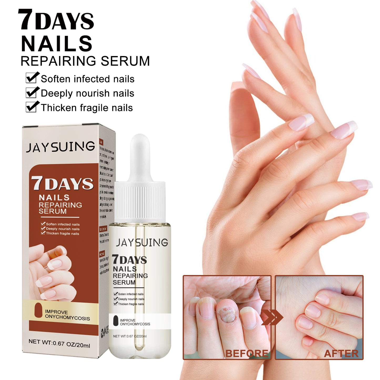 Jaysuing 7Nail Care Essence Onychomycosis Hand and Foot Nail Nutritional Cleansing Care Essence