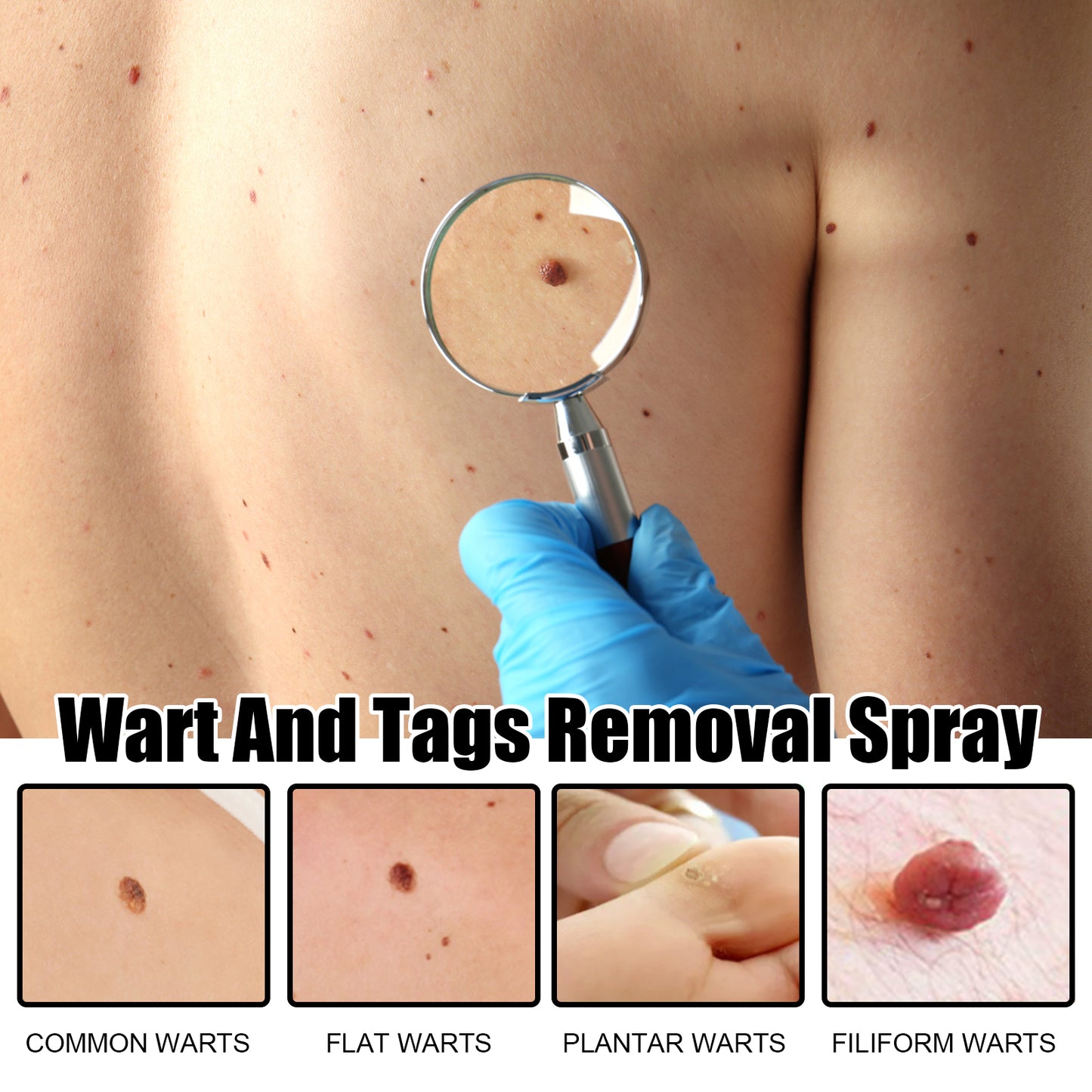 Ximonth Bee Venom Wart Care Spray Clean and fade body moles, smooth skin, and repair spray