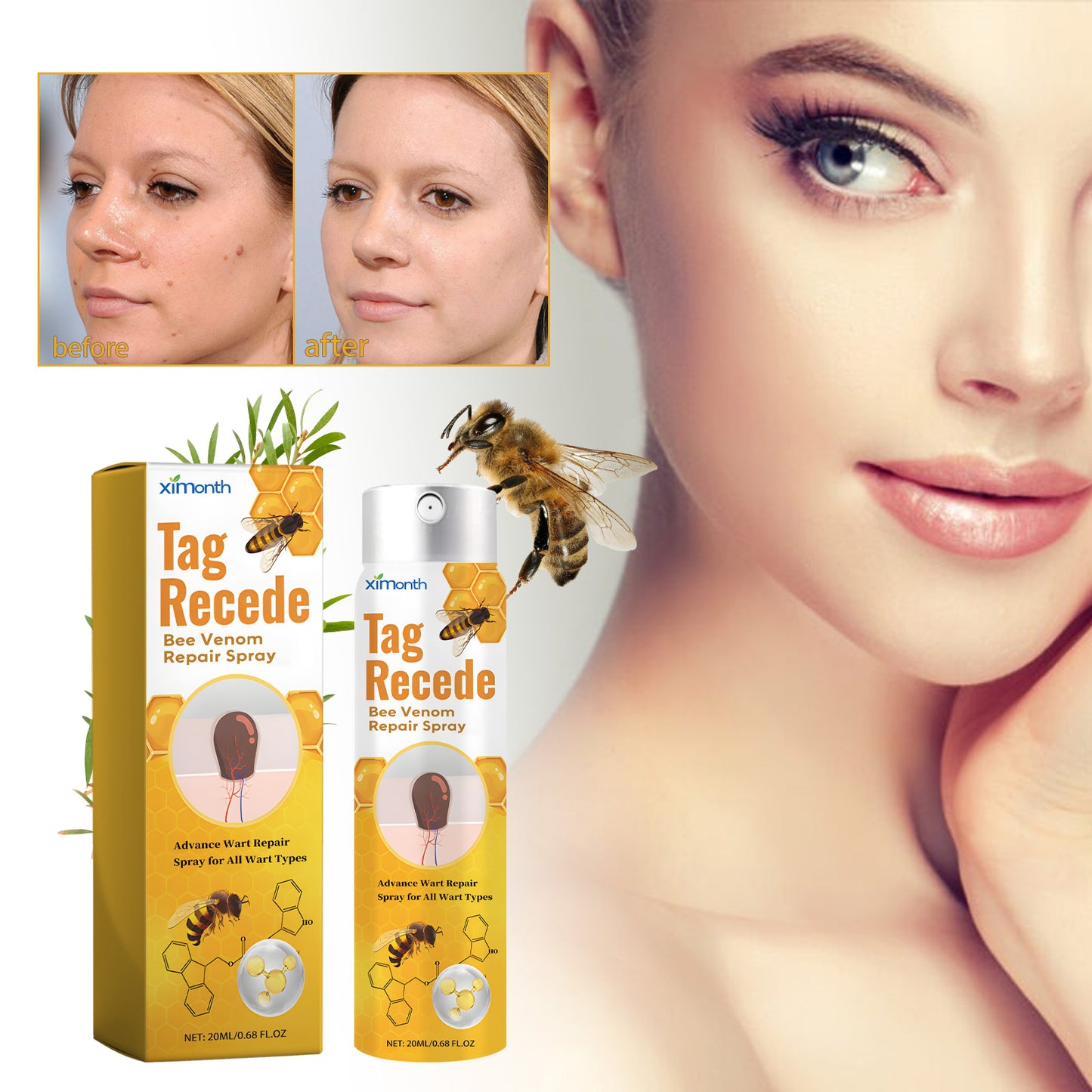 Ximonth Bee Venom Wart Care Spray Improve Skin Texture, Repair Moles, Smooth Skin, Wart Removal Spray