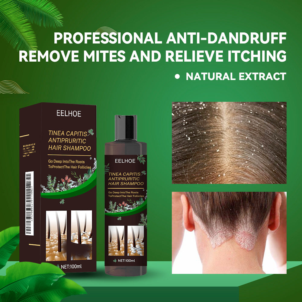 EELHOE Anti-Dandruff Itch Relief Shampoo Anti-shedding Refreshing Oil Control Hair Care Anti-dandruff Anti-itch Shampoo