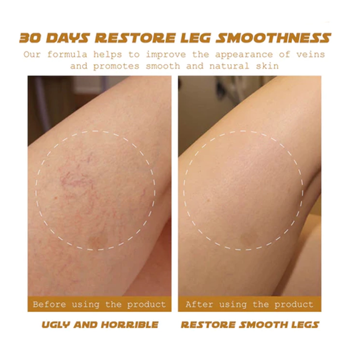 Ximonth Varicose Vein Massage Cream Relieve Soreness Leg Massage Varicose Earthworm Leg Vein Care Cream