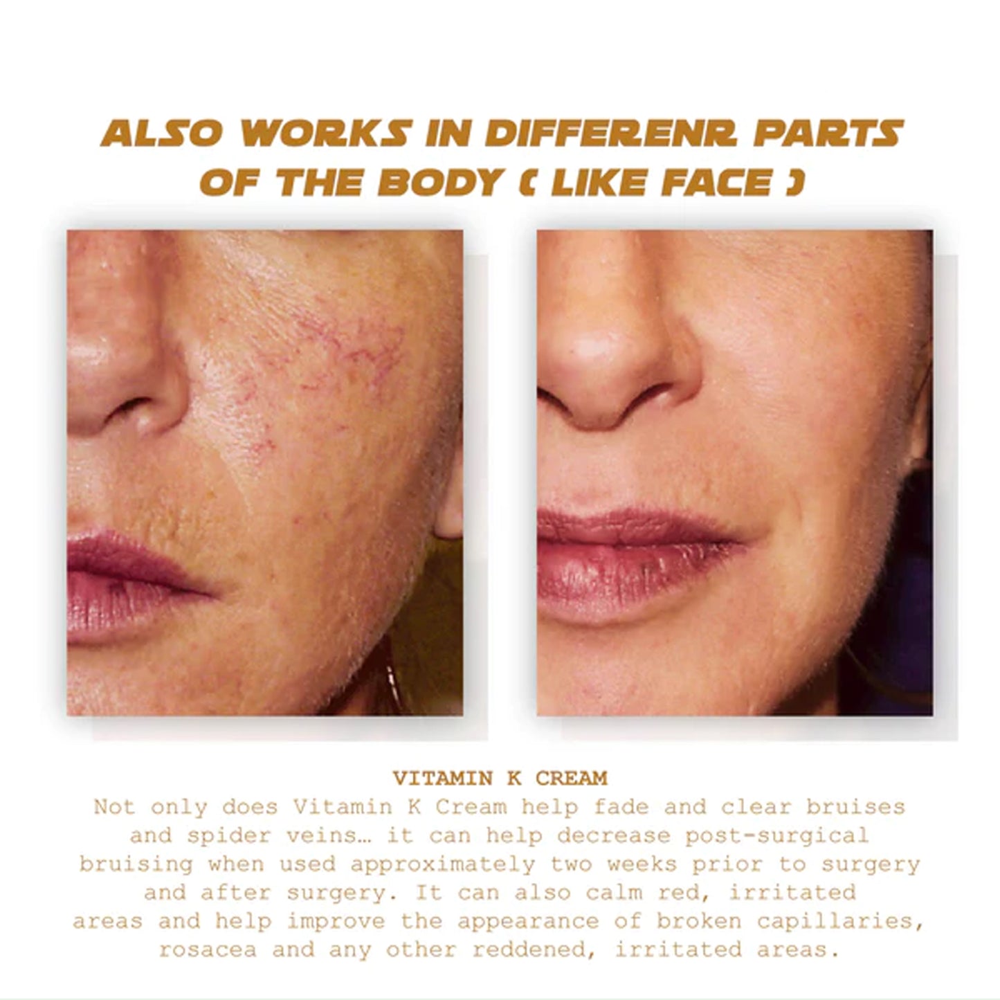 Ximonth Varicose Vein Massage Cream Relieve Soreness Leg Massage Varicose Earthworm Leg Vein Care Cream