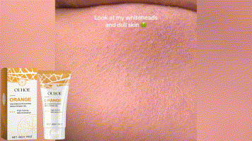 OUHOE Exfoliating Blackhead Gel Gentle Exfoliating Cleansing Gel Deep Purifying Pores Remove Blackheads Brighten Skin Tone