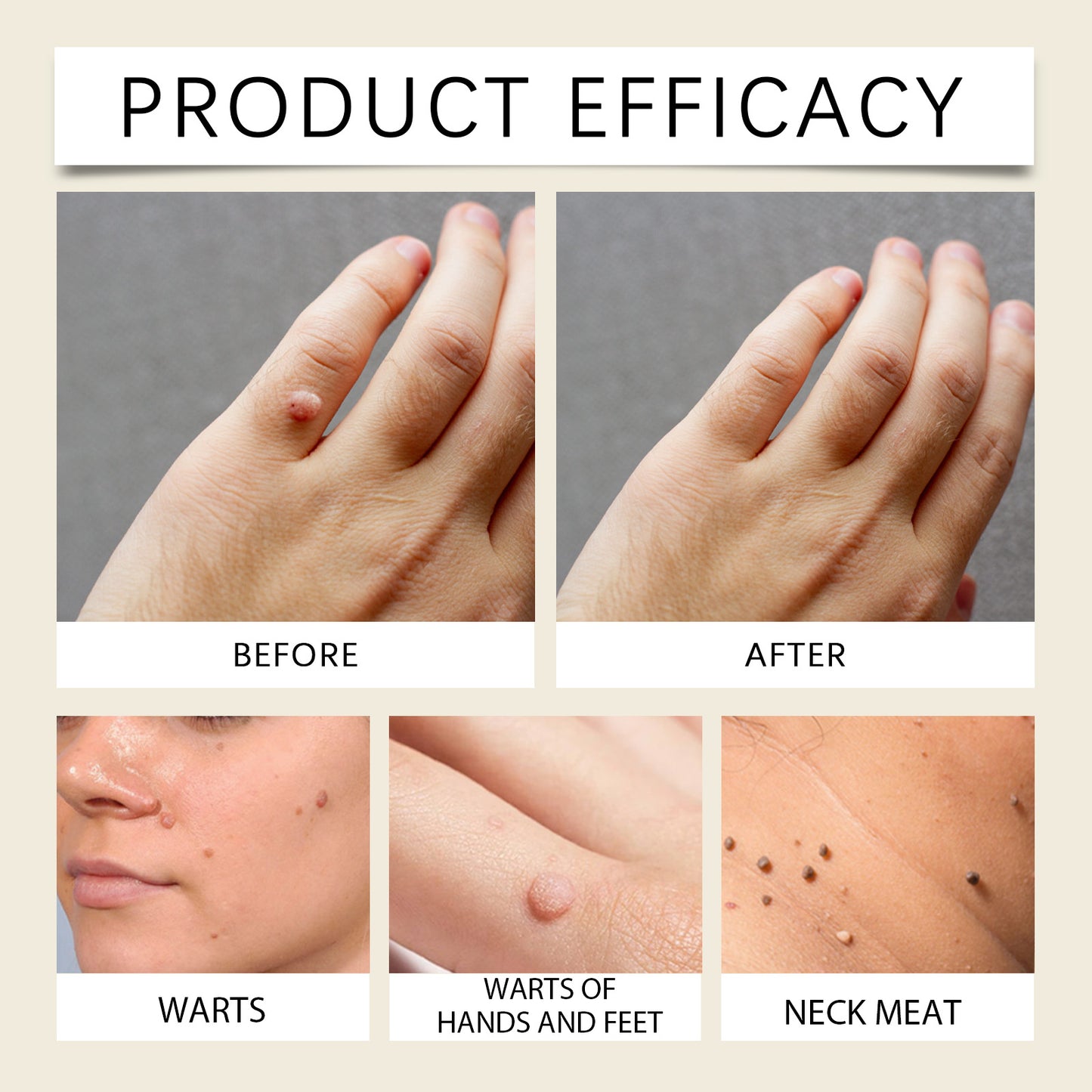 Ximonth Keyou Mole Cream Gentle Cleansing Skin Smooth Skin Moisturizing Repair Skin Care Cream