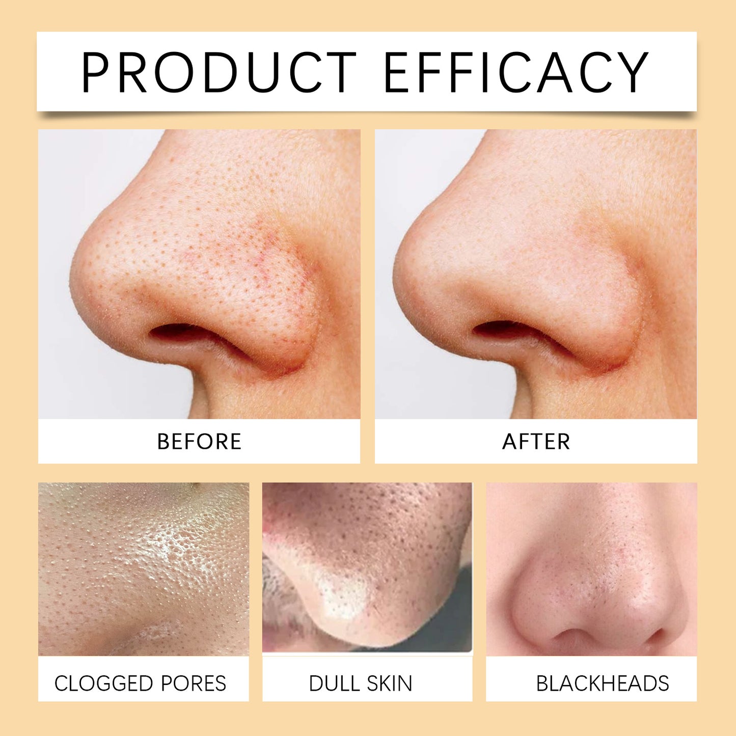 OUHOE Exfoliating Blackhead Gel Gentle Exfoliating Cleansing Gel Deep Purifying Pores Remove Blackheads Brighten Skin Tone