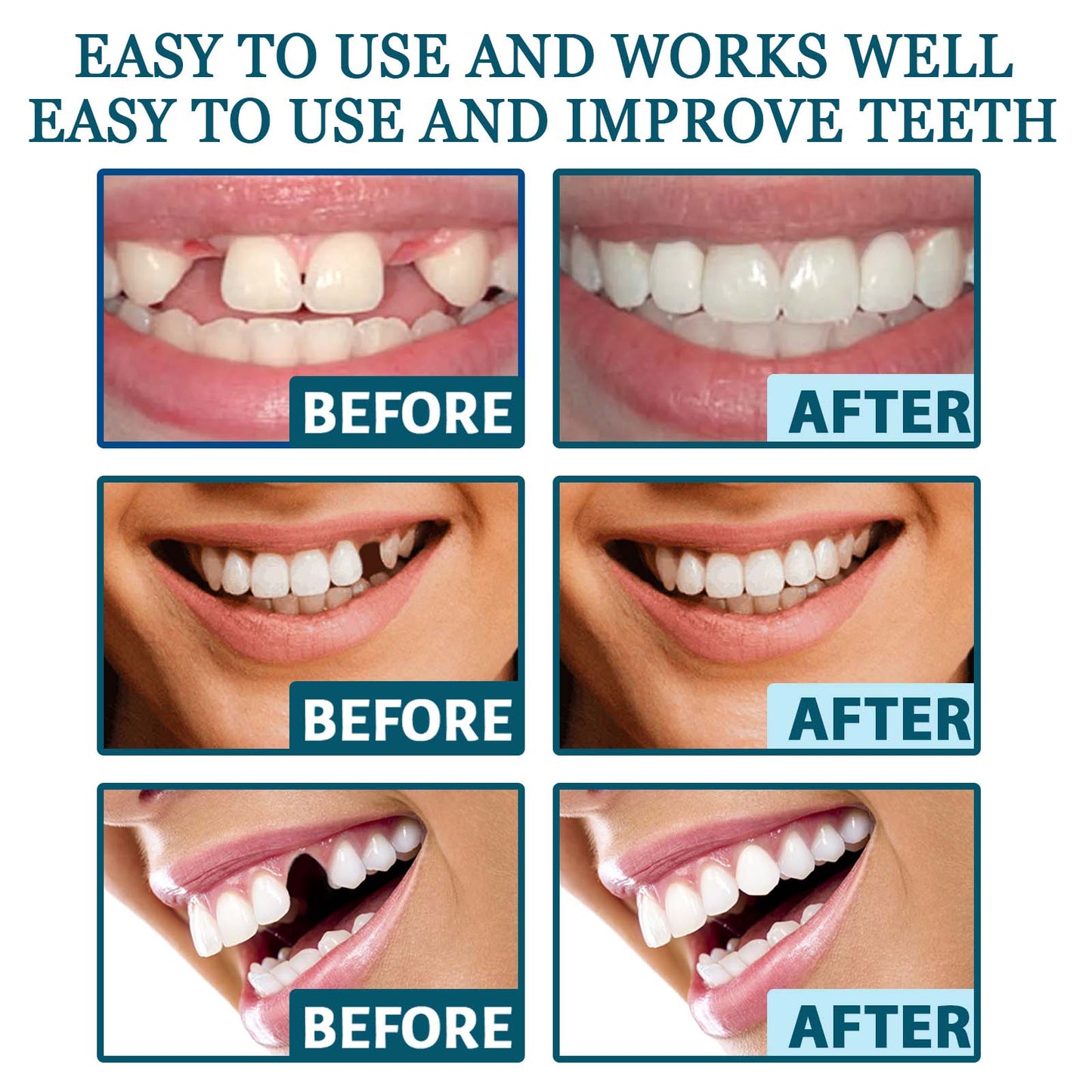 EELHOE Adjustable Snap-on Dentures Temporary Tooth Filling Gap Repair Teeth Correction Denture Kit