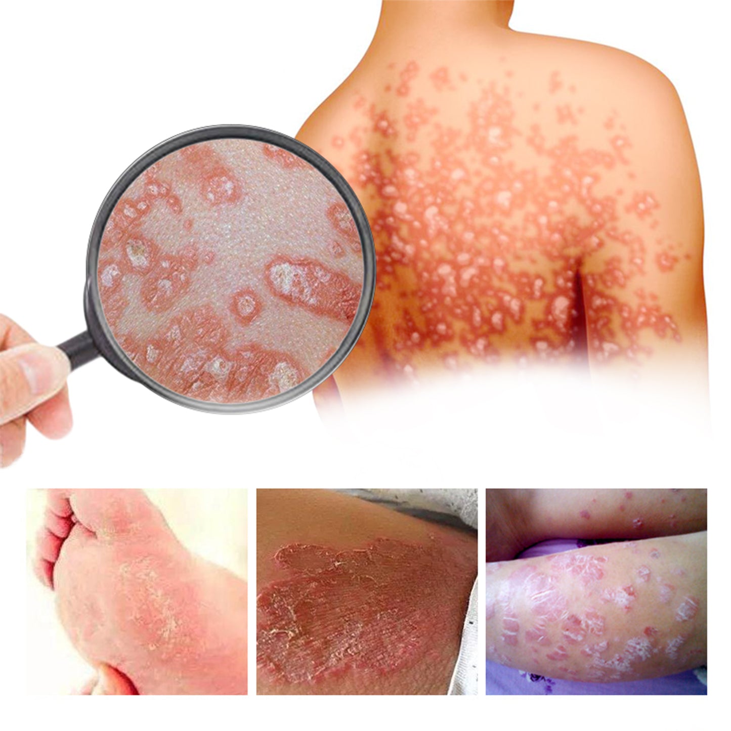 South Moon Skin Repair Cream Relieve itchy skin, repair hand and foot fungus, moisturize skin care cream