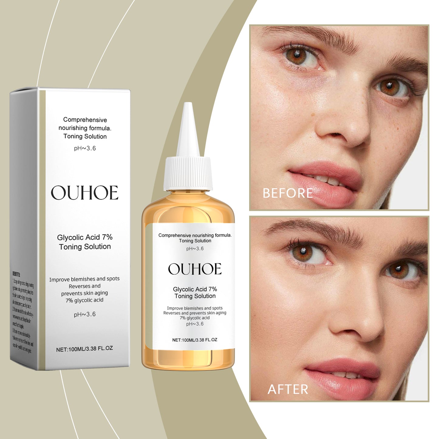 OUHOE Glycolic acid7%Moisturizing Toner，Remove Closed Comedones, Improve Skin Condition, Rejuvenate and Refresh Skin Essence